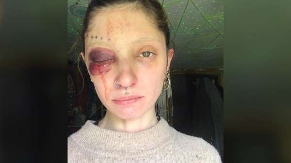 Суд отправил под стражу бывшего мужа грузинской модели по делу о насилии