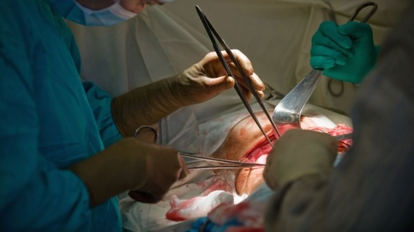 Правительство Грузии планирует упростить процедуры для трансплантации органов Правительство Грузии планирует упростить процедуры для трансплантации органов