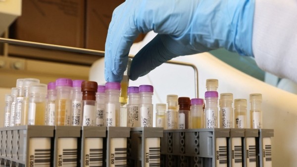 Грузия против гепатита С: эффективность лечения по госпрограмме - 99%