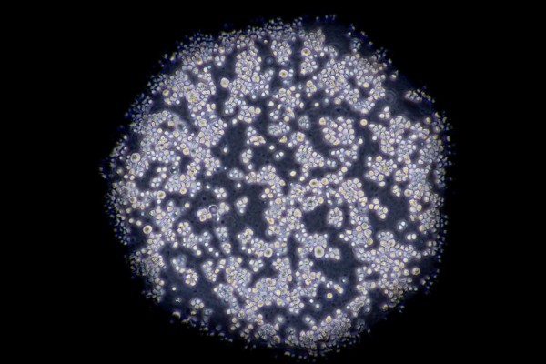 Ученые нашли потенциальный способ самоуничтожения опухолевых клеток – станет ли это открытие возможностью победить рак? Ученые нашли потенциальный способ самоуничтожения опухолевых клеток – станет ли это открытие возможностью победить рак?