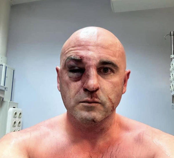 СМИ сообщают о жестоком избиении председателя ЕНД полицией на митинге в Тбилиси