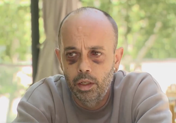 Гражданин США говорит о жестоком избиении на митинге в Тбилиси – в МВД все отрицают Гражданин США говорит о жестоком избиении на митинге в Тбилиси – в МВД все отрицают