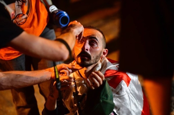 Месяц протестов в Грузии – десятки избитых демонстрантов, ни одного задержанного полицейского Месяц протестов в Грузии – десятки избитых демонстрантов, ни одного задержанного полицейского