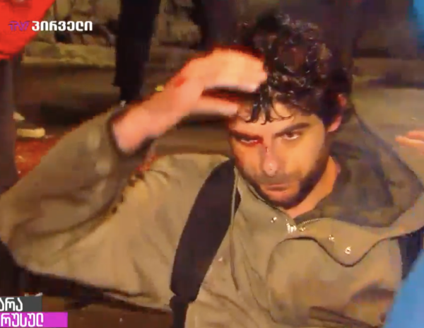 Неизвестные напали на протестующих в Тбилиси Неизвестные напали на протестующих в Тбилиси