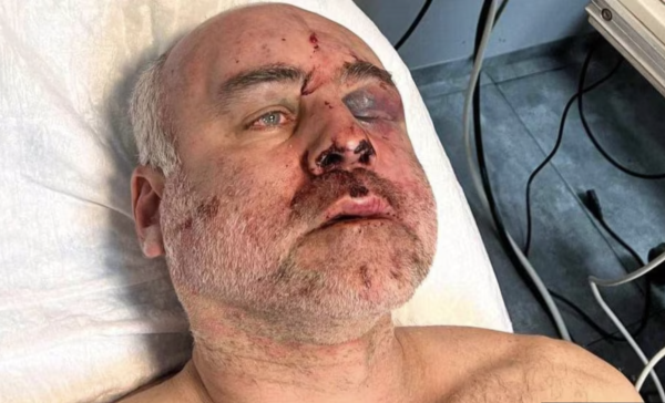 В Грузии начали расследование по факту избиения активиста Дато Кацарава при задержании