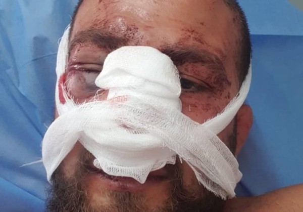 В Тбилиси группой неизвестных жестоко избит активист Лери Дарджания В Тбилиси группой неизвестных жестоко избит активист Лери Дарджания