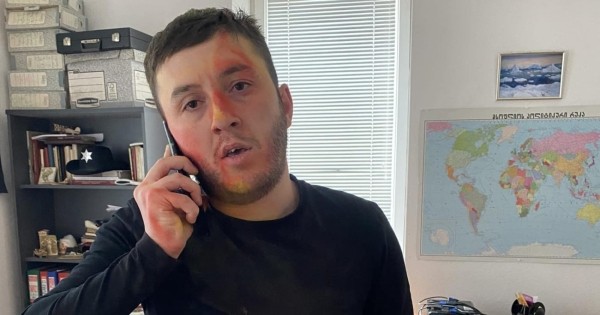 В Тбилиси напали на сотрудника «Лаборатории исследования советского прошлого» В Тбилиси напали на сотрудника «Лаборатории исследования советского прошлого»