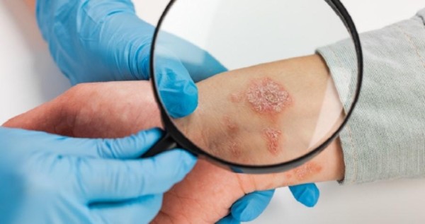 Искусственный интеллект разработал два новых антибиотика - ученые считают, что ИИ может создать «второй золотой век» в медицине