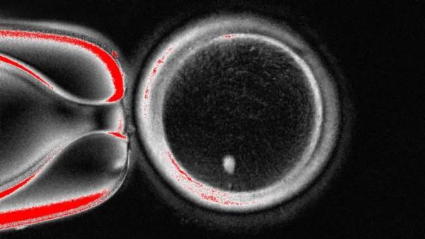 Впервые в истории ученые создали эмбрион, использовав ДНК из клеток кожи человека - Почему это важно для бесплодных пар
