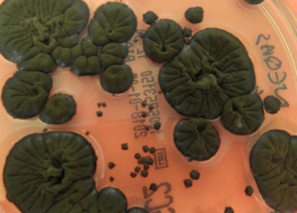 В Чернобыле происходит что-то странное - на АЭС обнаружен гриб, который питается радиацией и преобразует ее в энергию В Чернобыле происходит что-то странное - на АЭС обнаружен гриб, который питается радиацией и преобразует ее в энергию