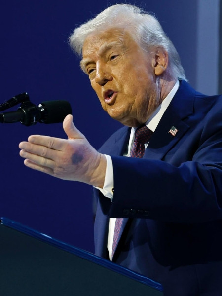 Что случилось с руками Трампа и почему у него синяки? - «Врач мне сказал, что...» Что случилось с руками Трампа и почему у него синяки? - «Врач мне сказал, что...»